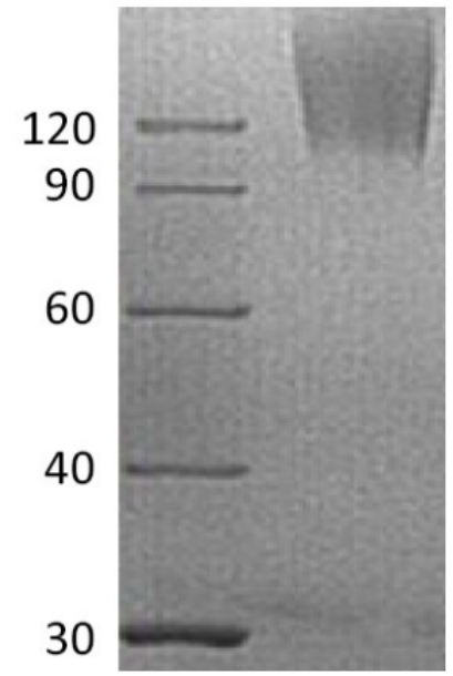 CEA Antigen