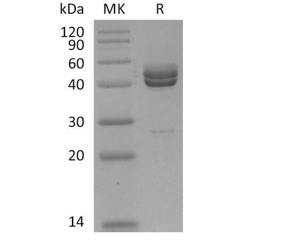 CK-MB1 Antigen