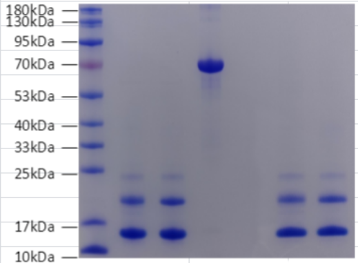 SAA1 Antigen