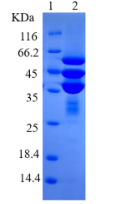 TP Antigen
