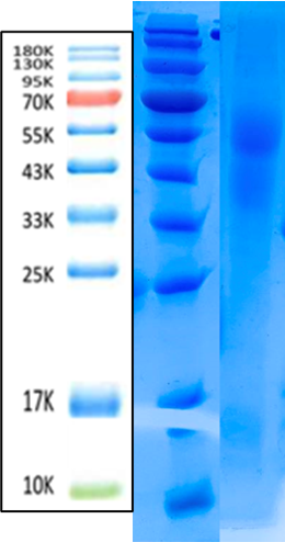 sFlt-1 Antigen