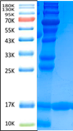 B2M Antigen