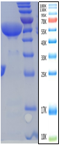 HP-CagA Antigen