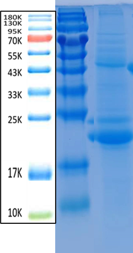 IFN-γ Antigen