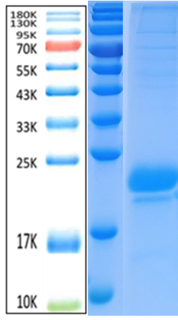 IL-1β Antigen