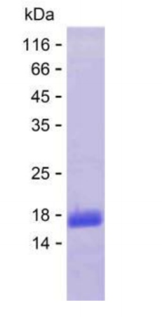 IL-1β Antigen