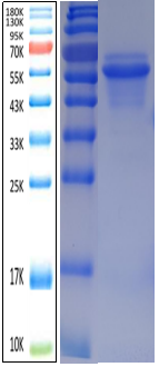 IL-12 Antigen