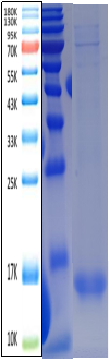 IL-5 Antigen