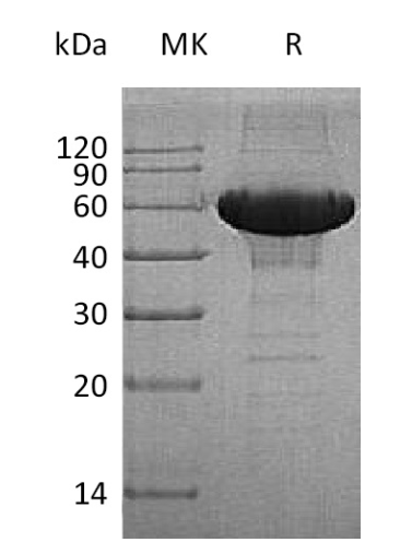 MMP-3 Antigen