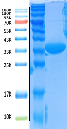 Malaria Pv-LDH Antigen