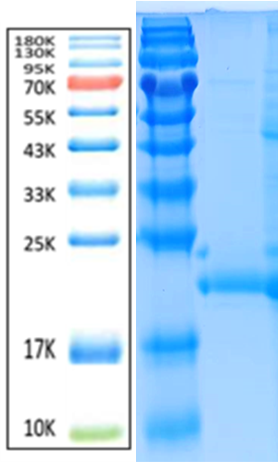 NGAL Antigen