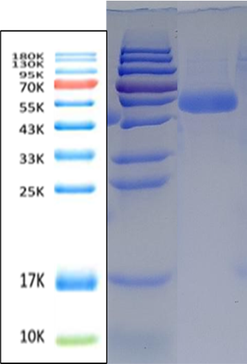 PLA2R Antigen